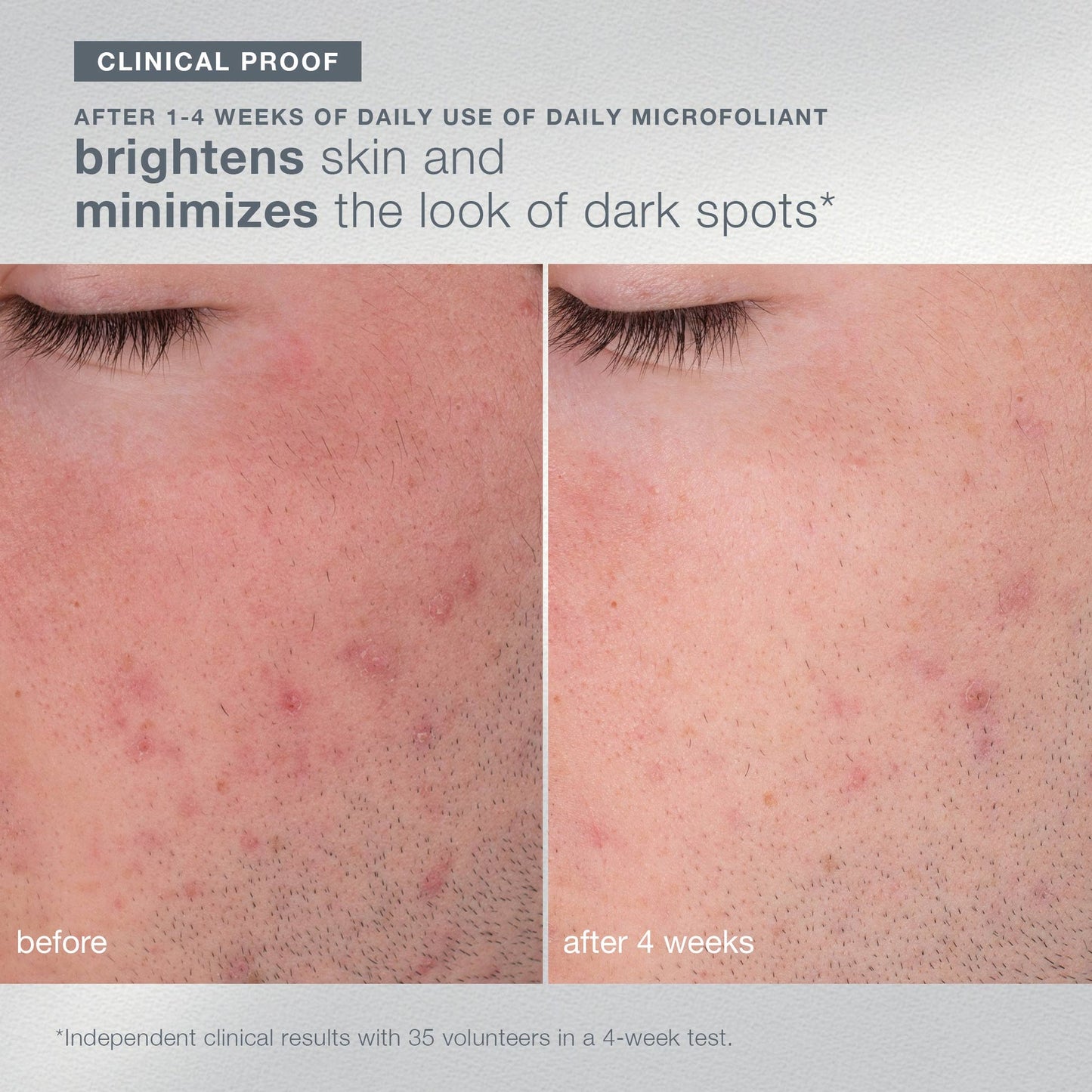 煥光綻放潔膚套裝 let it glow set