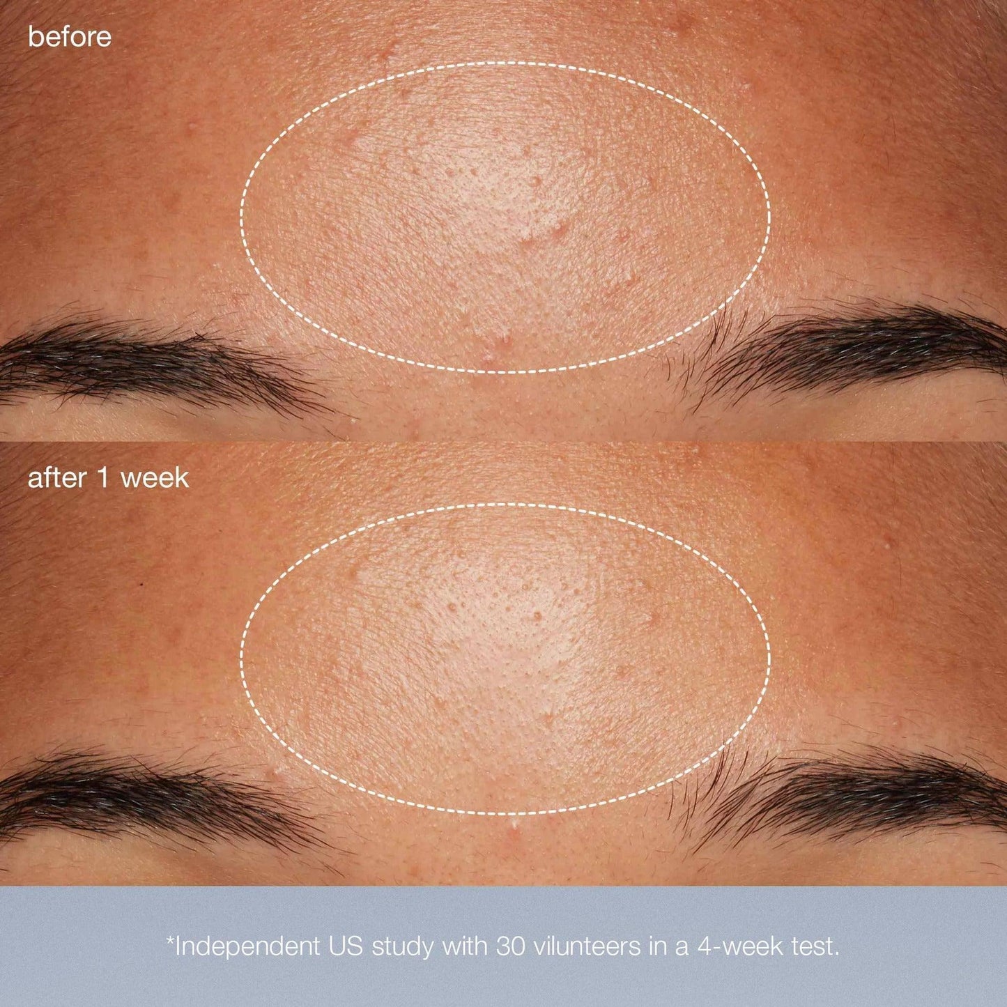 daily microfoliant exfoliator - Dermalogica Hong Kong