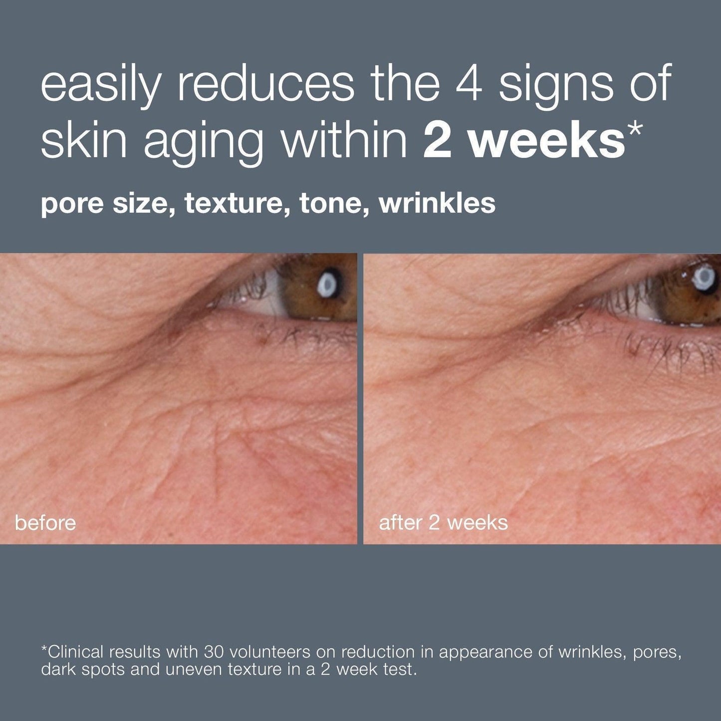 dynamic skin retinol serum - Dermalogica Hong Kong