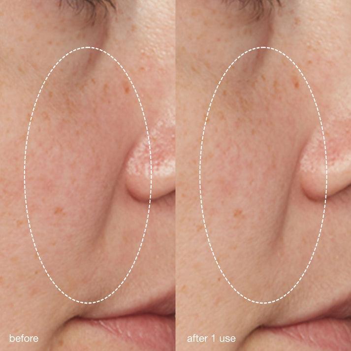 liquid peelfoliant - Dermalogica Hong Kong
