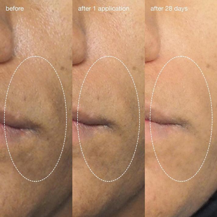 liquid peelfoliant - Dermalogica Hong Kong
