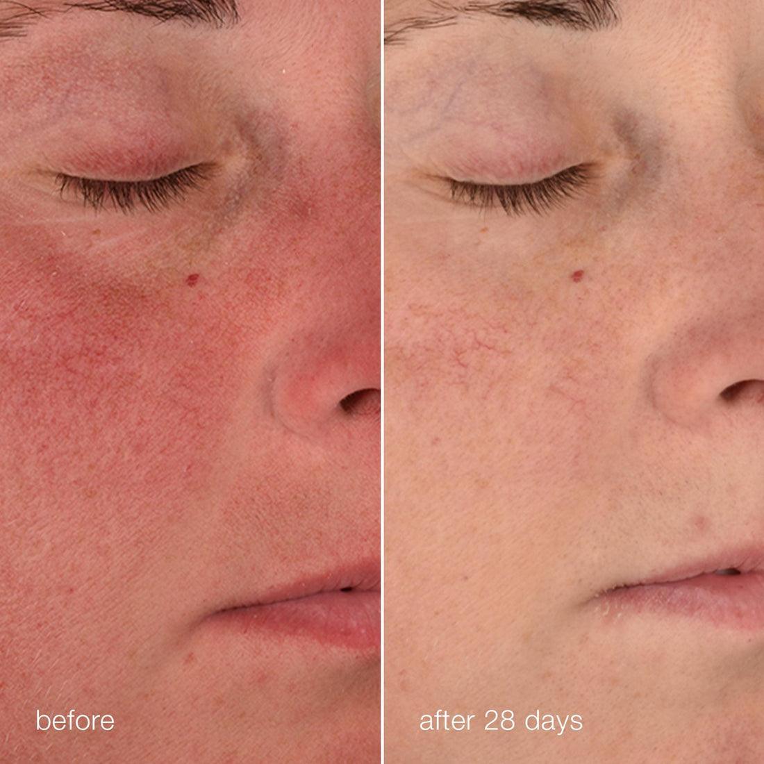 stabilizing repair cream - Dermalogica Hong Kong