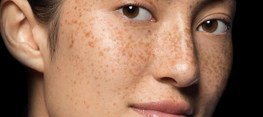 skin damage: everything you need to know - Dermalogica Hong Kong