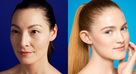 The difference between adult acne and teen acne - Dermalogica Hong Kong
