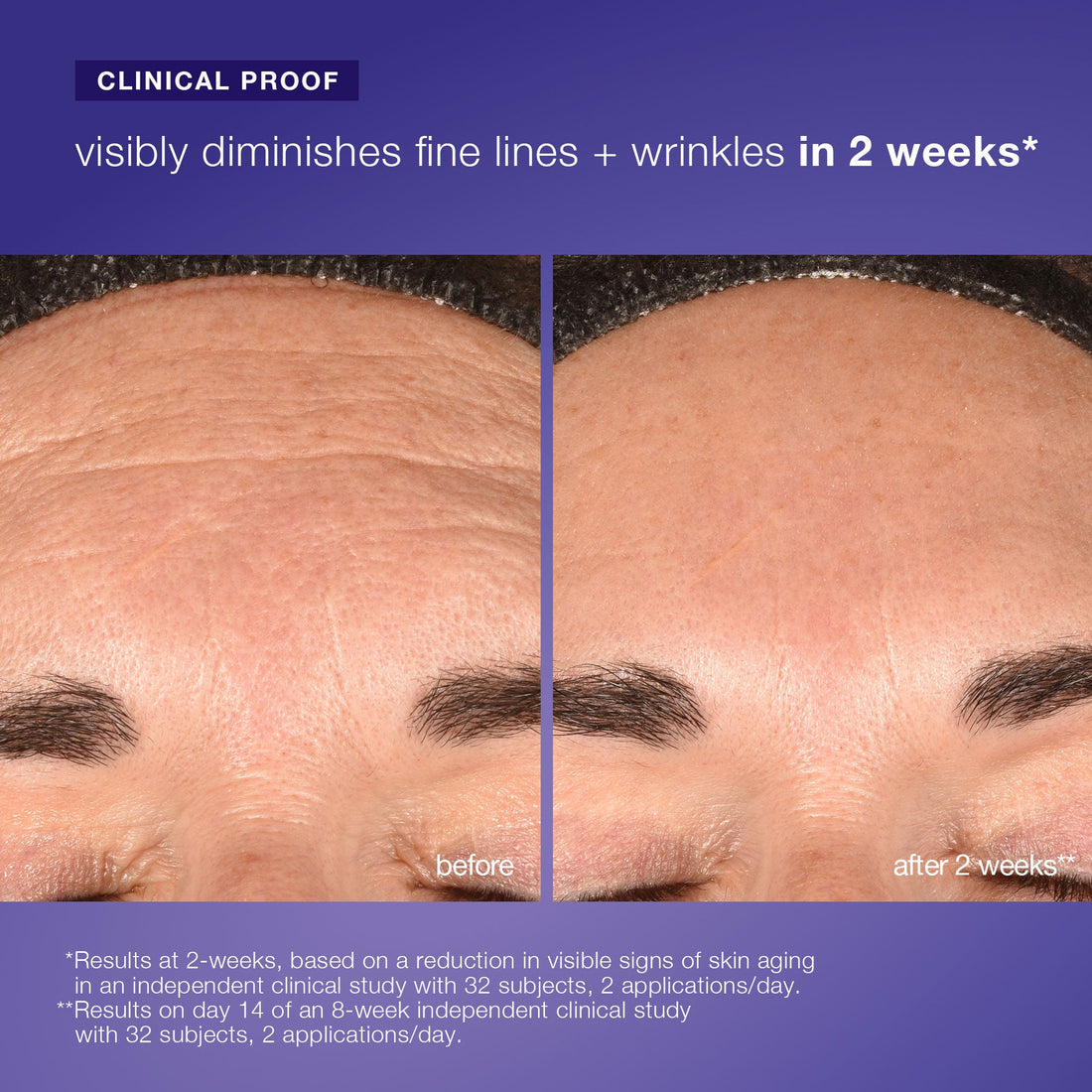 phyto nature e² 植物重塑外泌體酵素肌底液