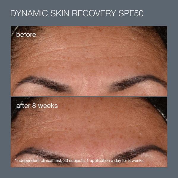 skin aging solutions set (2 full-size best sellers) - Dermalogica Hong Kong